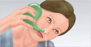 agopuntura, sinusite, rinosinusite