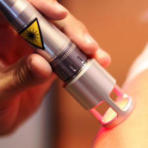 laser, corso, agopuntura, posturologia, mesoterapia