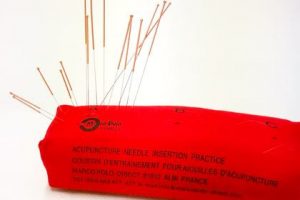 Agopuntura scientifica nel terzo millennio
