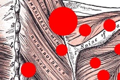 Dolore Muscolare e Fasciale