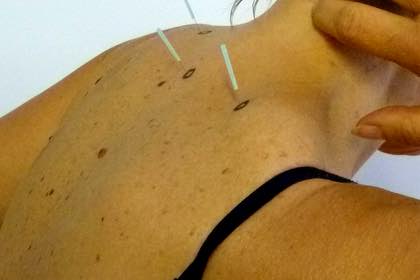 Riflessoterapia Pratica