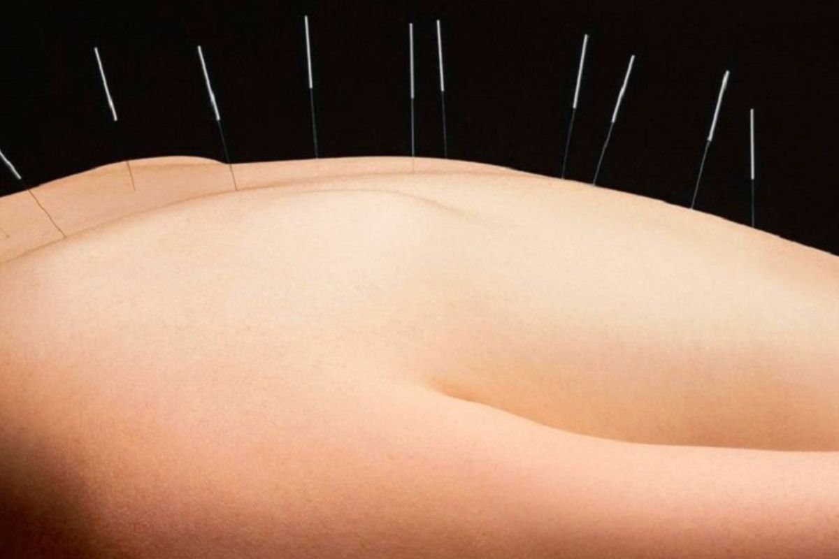 master-agopuntura04 Master Riflessoterapia