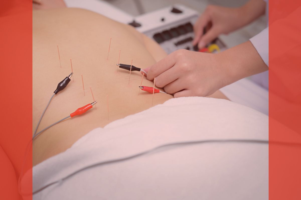 Elettoagopuntura pratica 2025