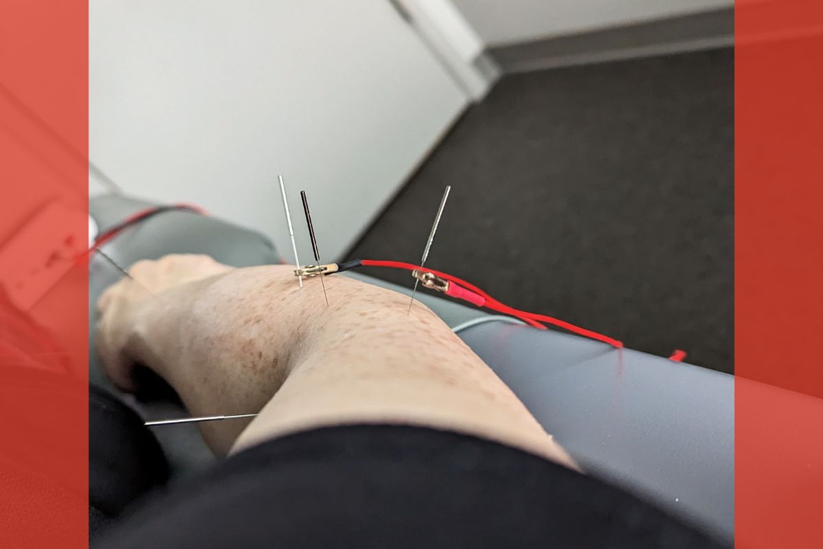 ElettroAgopuntura Pratica 2025