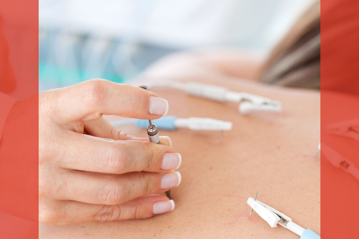 ElettroAgopuntura Pratica 2025